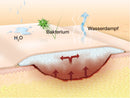 Suprasorb P non-adhesive