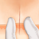 Histoacryl® B.Braun