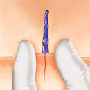 Histoacryl® B.Braun